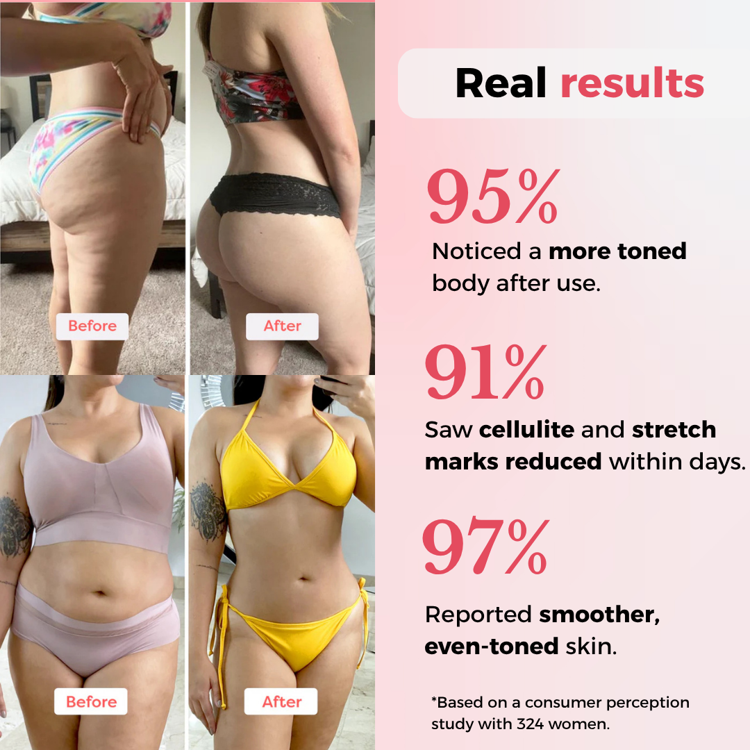 Anti-cellulite Vaccum massager